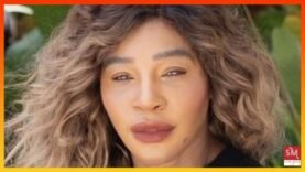 Serena Williams DID NOT bleach her skin!(Full breakdown)