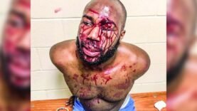 Mississippi Man David Logan Brutally Beaten By Cops During A Traffic Stop