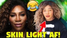 Serena Williams Gets Exposed For Skin Lightening And Trying To Look White AGAIN…AND GUESS WHO MAD?