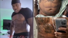 Bandman Kevo REVEALS His New Body Abs After Skipping The Gym & Getting LIPOSUCTION