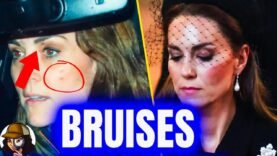 *NOT CLICKBAIT*|SHOCKING LEAKED PHOTOS Of Kate|William MUST Answer 4 This!|WHAT DID HE DO TO HER?