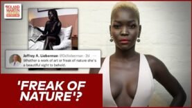 ‘Freak Of Nature’?: Columbia Suspends Psychiatry Head Over Tweet About Dark-Skinned Model | #RMU