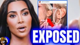 Kim EXPOSED|Accused Of Getting FACELIFT After PICS Of Scars Go VIRAL| All 4 New App She’s Launching?