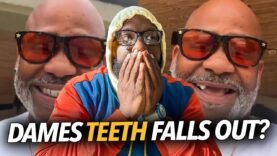 “He’s Hit Rock Bottom… ” Dame Dash’s Teeth Falls Out While He’s Trying To Go At 50 Cent On IG Live