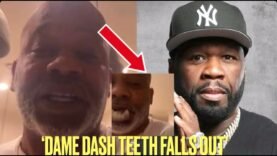 Dame Dash DENTURES FALLS OUT While Speaking On 50 Cent After He Called Him BROKE